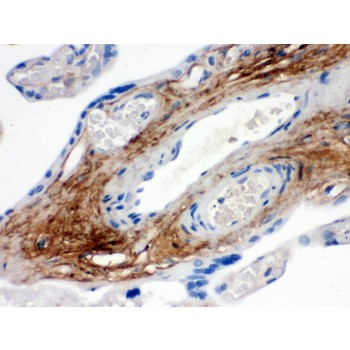 TNXB / Tenascin XB Antibody - TNXB antibody IHC-paraffin. IHC(P): Human Placenta Tissue.