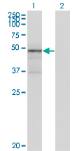 TNXB / Tenascin XB Antibody - Western blot of TNXB expression in transfected 293T cell line by TNXB monoclonal antibody (M01), clone 2D3-1B10.