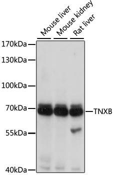 TNXB / Tenascin XB Antibody - Western blot analysis of extracts of various cell lines using TNXB Polyclonal Antibody at dilution of 1:1000.