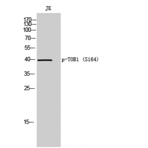 TOB1 / TOB Antibody - Western blot of Phospho-TOB1 (S164) antibody