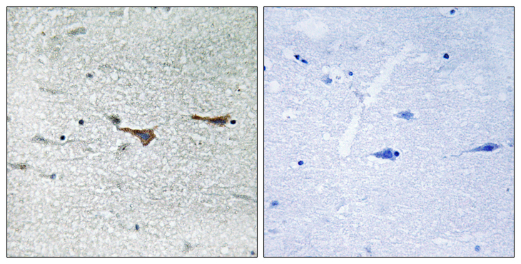 TOB1 / TOB Antibody - Immunohistochemistry analysis of paraffin-embedded human brain tissue, using TOB1 Antibody. The picture on the right is blocked with the synthesized peptide.