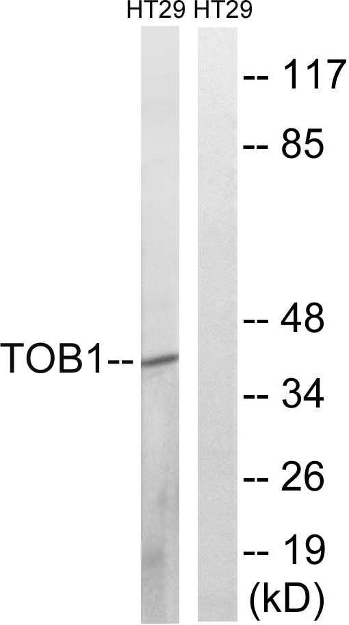 TOB1 / TOB Antibody - Western blot analysis of lysates from HT-29 cells, treated with serum 20% 15', using TOB1 Antibody. The lane on the right is blocked with the synthesized peptide.