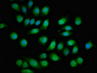 TOB1 / TOB Antibody - Immunofluorescent analysis of A549 cells at a dilution of 1:100 and Alexa Fluor 488-congugated AffiniPure Goat Anti-Rabbit IgG(H+L)