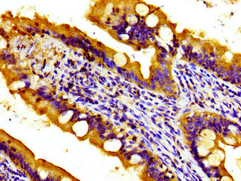 TOB1 / TOB Antibody - Immunohistochemistry image of paraffin-embedded human small intestine tissue at a dilution of 1:100