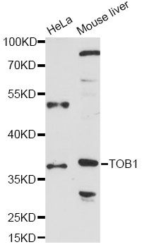 TOB1 / TOB Antibody - Western blot analysis of extracts of various cell lines, using TOB1 antibody at 1:1000 dilution. The secondary antibody used was an HRP Goat Anti-Rabbit IgG (H+L) at 1:10000 dilution. Lysates were loaded 25ug per lane and 3% nonfat dry milk in TBST was used for blocking. An ECL Kit was used for detection and the exposure time was 90s.