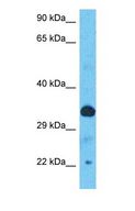TOB1 / TOB Antibody - Western blot of TOB1 Antibody with human Ovary Tumor lysate.  This image was taken for the unconjugated form of this product. Other forms have not been tested.