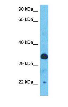 TOB1 / TOB Antibody - Western blot of TOB1 Antibody with human Ovary Tumor lysate.  This image was taken for the unconjugated form of this product. Other forms have not been tested.