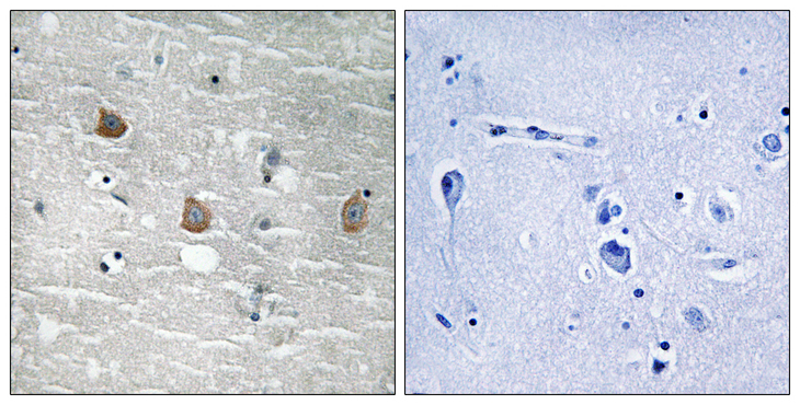 TOB1 / TOB Antibody - Immunohistochemistry analysis of paraffin-embedded human brain, using TOB1 (Phospho-Ser164) Antibody. The picture on the right is blocked with the phospho peptide.