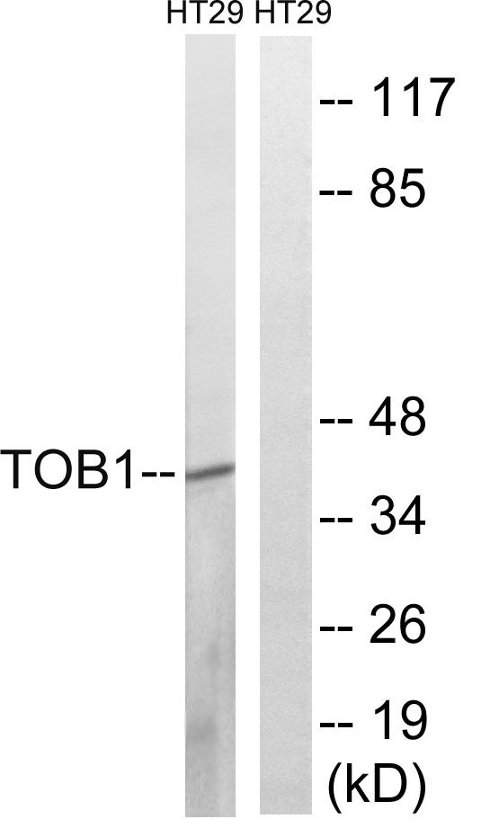 TOB1 / TOB Antibody - Western blot analysis of lysates from HT29 cells treated with serum 20% 15', using TOB1 (Phospho-Ser164) Antibody. The lane on the right is blocked with the phospho peptide.