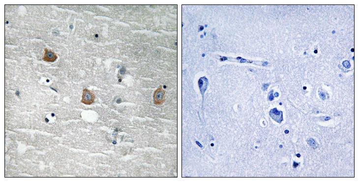 TOB1 / TOB Antibody - P-peptide - + Immunohistochemistry analysis of paraffin-embedded human brain tissue using TOB1 (Phospho-Ser164) antibody.