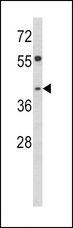 TOB2 Antibody - Western blot of TOB2 Antibody in HepG2 cell line lysates (35 ug/lane). TOB2 (arrow) was detected using the purified antibody.