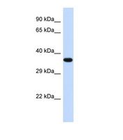 TOB2 Antibody - Western blot of Human Fetal Heart. TOB2 antibody dilution 1.0 ug/ml.  This image was taken for the unconjugated form of this product. Other forms have not been tested.