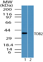 TOB2 Antibody - Western blot of TOB2 in human heart lysate in the 1) absence and 2) presence of immunizing peptide using Polyclonal Antibody to TOB2 at 0.5 ug/ml.