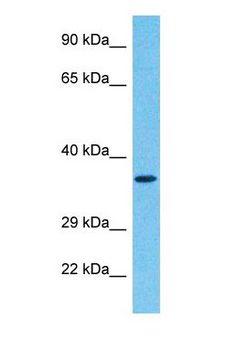 TOB2 Antibody - Western blot of TOB2 Antibody with human 721_B Whole Cell lysate.  This image was taken for the unconjugated form of this product. Other forms have not been tested.