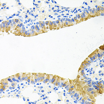 TOB2 Antibody - Immunohistochemistry of paraffin-embedded mouse lung tissue.