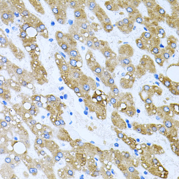 TOB2 Antibody - Immunohistochemistry of paraffin-embedded human liver injury tissue.