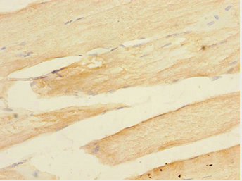 TOB2 Antibody - Immunohistochemistry of paraffin-embedded human skeletal Muscle at dilution 1:100