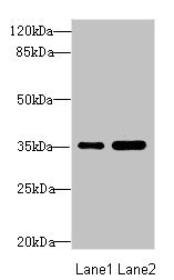 TOB2 Antibody - Western blot All Lanes: TOB2 antibody at 1.89ug/ml Lane 1: Mouse skeletal muscle tissue Lane 2: Mouse heart tissue Secondary Goat polyclonal to Rabbit IgG at 1/10000 dilution Predicted band size: 37,28 kDa Observed band size: 37 kDa