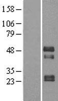 TOB2 Protein - Western validation with an anti-DDK antibody * L: Control HEK293 lysate R: Over-expression lysate