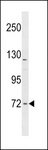 TOCA1 / FNBP1L Antibody - FNBP1L Antibody western blot of mouse lung tissue lysates (35 ug/lane). The FNBP1L antibody detected the FNBP1L protein (arrow).