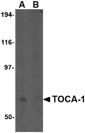 TOCA1 / FNBP1L Antibody - Western blot of TOCA-1 in human brain tissue lysate in (A) the absence and (B) the presence of blocking peptide with TOCA-1 antibody at 0.5 ug/ml.