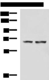 TOCA1 / FNBP1L Antibody - Western blot analysis of Human cerebella tissue Human cerebrum tissue lysates  using FNBP1L Polyclonal Antibody at dilution of 1:750