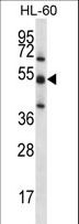 TOE1 Antibody - TOE1 Antibody western blot of HL-60 cell line lysates (35 ug/lane). The TOE1 antibody detected the TOE1 protein (arrow).