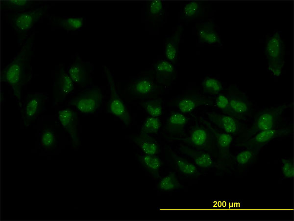 TOE1 Antibody - Immunofluorescence of monoclonal antibody to TOE1 on HeLa cell. [antibody concentration 10 ug/ml]