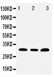 TOLLIP Antibody - WB of TOLLIP antibody. Lane1: PANC Cell Lysate. Lane2: HELA Cell Lysate. Lane3: U87 Cell Lysate..