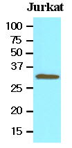 TOLLIP Antibody - Cell lysates of Jurkat (30 ug) were resolved by SDS-PAGE, transferred to NC membrane and probed with anti-human Tollip (1:500). Proteins were visualized using a goat anti-mouse secondary antibody conjugated to HRP and an ECL detection system.