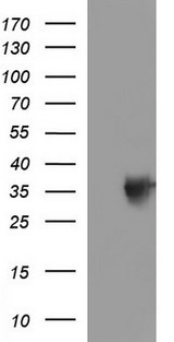 TOLLIP Antibody - HEK293T cells were transfected with the pCMV6-ENTRY control (Left lane) or pCMV6-ENTRY TOLLIP (Right lane) cDNA for 48 hrs and lysed. Equivalent amounts of cell lysates (5 ug per lane) were separated by SDS-PAGE and immunoblotted with anti-TOLLIP.