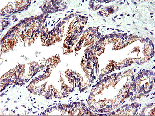 TOLLIP Antibody - IHC of paraffin-embedded Human prostate tissue using anti-TOLLIP mouse monoclonal antibody. (Heat-induced epitope retrieval by 10mM citric buffer, pH6.0, 120°C for 3min).