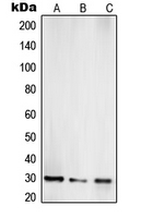 TOLLIP Antibody - Western blot analysis of TOLLIP expression in Jurkat (A); LNCaP (B); HepG2 (C) whole cell lysates.