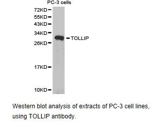 TOLLIP Antibody - Western blot.