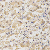 TOLLIP Antibody - Immunohistochemistry of paraffin-embedded human stomach tissue.