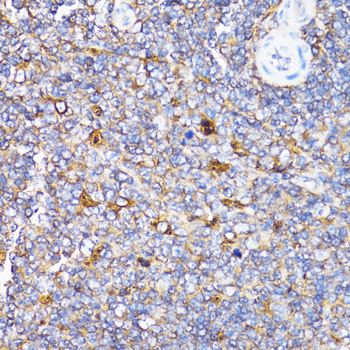 TOLLIP Antibody - Immunohistochemistry of paraffin-embedded rat spleen tissue.