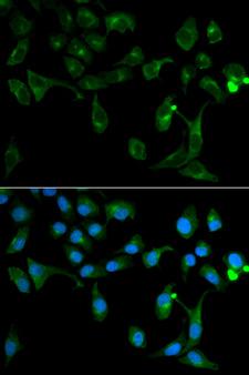 TOLLIP Antibody - Immunofluorescence analysis of U2OS cells.