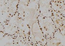 TOLLIP Antibody - 1:100 staining human lung tissue by IHC-P. The sample was formaldehyde fixed and a heat mediated antigen retrieval step in citrate buffer was performed. The sample was then blocked and incubated with the antibody for 1.5 hours at 22°C. An HRP conjugated goat anti-rabbit antibody was used as the secondary.