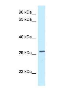 TOLLIP Antibody - TOLLIP antibody Western blot of Mouse Brain lysate. Antibody concentration 1 ug/ml.  This image was taken for the unconjugated form of this product. Other forms have not been tested.