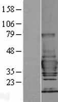 TOLLIP Protein - Western validation with an anti-DDK antibody * L: Control HEK293 lysate R: Over-expression lysate
