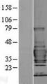 TOLLIP Protein - Western validation with an anti-DDK antibody * L: Control HEK293 lysate R: Over-expression lysate