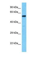 TOM1 Antibody - Western blot of TOM1 Antibody with 786-0 Whole Cell lysate.  This image was taken for the unconjugated form of this product. Other forms have not been tested.