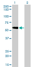 TOM1 Antibody - Western blot of TOM1 expression in transfected 293T cell line by TOM1 monoclonal antibody (M01), clone 5A3.
