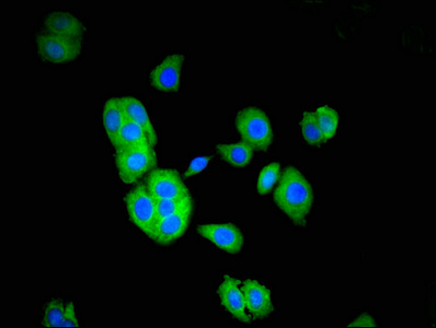 TOM1 Antibody - Immunofluorescent analysis of HepG2 cells at a dilution of 1:100 and Alexa Fluor 488-congugated AffiniPure Goat Anti-Rabbit IgG(H+L)
