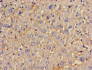 TOM1 Antibody - Immunohistochemistry image of paraffin-embedded human liver tissue at a dilution of 1:100