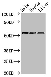 TOM1 Antibody - Positive Western Blot detected in Hela whole cell lysate, HepG2 whole cell lysate, Mouse liver tissue. All lanes: TOM1 antibody at 2.4 µg/ml Secondary Goat polyclonal to rabbit IgG at 1/50000 dilution. Predicted band size: 54, 49, 51 KDa. Observed band size: 54 KDa