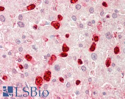 TOM1L1 Antibody - Human Liver: Formalin-Fixed, Paraffin-Embedded (FFPE).  This image was taken for the unconjugated form of this product. Other forms have not been tested.