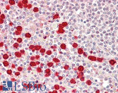 TOM1L1 Antibody - Human Spleen: Formalin-Fixed, Paraffin-Embedded (FFPE).  This image was taken for the unconjugated form of this product. Other forms have not been tested.