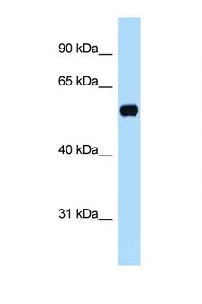 TOM1L1 Antibody - TOM1L1 antibody western blot of Human Fetal Brain lysate. Antibody concentration 1 ug/ml.  This image was taken for the unconjugated form of this product. Other forms have not been tested.