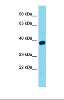 TOM1L1 Antibody - Western blot of Mouse Muscle . Tom1l1 antibody dilution 1.0 ug/ml.  This image was taken for the unconjugated form of this product. Other forms have not been tested.